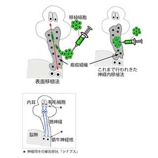 従来の考え方を覆す新たな細胞移植法で聴神経の再生に成功 - 京大