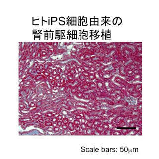 急性腎障害に対するヒトiPS細胞由来の腎前駆細胞の治療効果を確認 - 京大