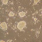 京大、生殖細胞を含む全ての組織・器官に分化するウシiPS細胞を作製