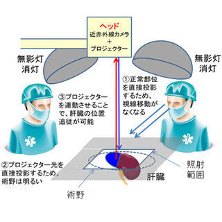 京大、プロジェクションマッピングを応用した外科手術支援システムを開発