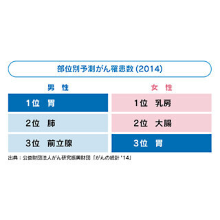 男女ともに注意が必要なのは「胃ガン」 - 早期発見のため年に1回検診を