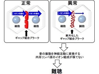 順天堂大など、遺伝性難聴で最も多い「GJB2変異型」の原因を解明