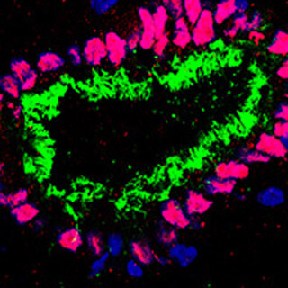 京大、ヒトiPS細胞から気道上皮細胞を効率よく分化 - 呼吸器疾患の解明に道