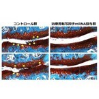 関節へのmRNA投与で変形性関節症の進行を抑制 - 東大が成功