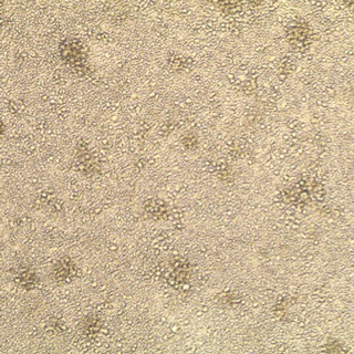京大CiRAなど、iPS細胞から免疫機能を高める細胞を作製