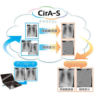 東陽テクニカ、胸部X線骨組織透過処理および経時差分処理をクラウドで提供