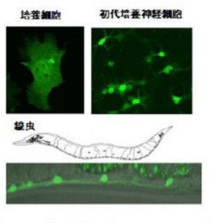 アルツハイマー病の原因因子の可視化に成功 - 発症の仕組み解明に期待