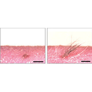 理研など、マウスiPS細胞で毛包や皮脂腺などを持つ皮膚器官系の再生に成功