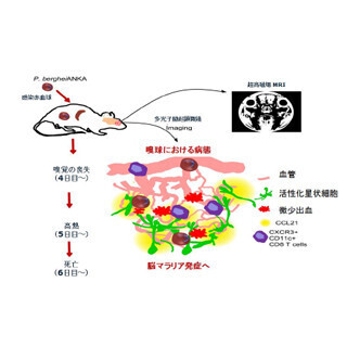 阪大、脳マラリアの新たな診断と治療のターゲットを発見