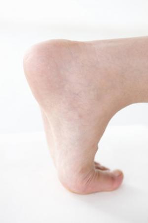 かかとの乾燥には新陳代謝と“肌の修復力を回復する”部位別対策が重要