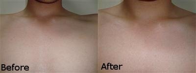 【突撃！COBS】日焼けサロンってどんなの？　色白な僕が初体験してみました