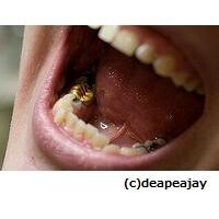 【コブスくんのモテ男道！】歯科医に聞く。保険診療と自由診療はどう違う？