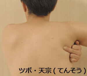 【コブスくんのモテ男道！】鍼灸師が教える。ゲームポーズの首痛・肩痛をセルフケア