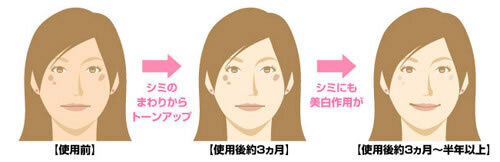 【雑学キング！】美白コスメを使っているのに、なぜシミが濃くなるの?