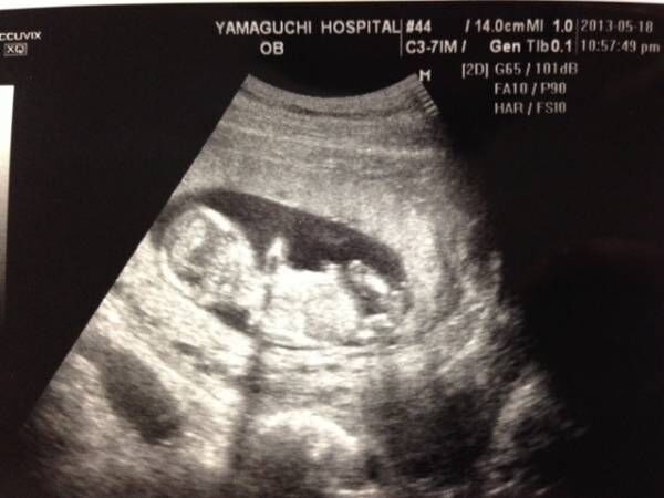 トントン ニョロニョロ お腹の赤ちゃんは今何してるの 胎動からわかる赤ちゃんのこと 18年10月25日 ウーマンエキサイト 1 2