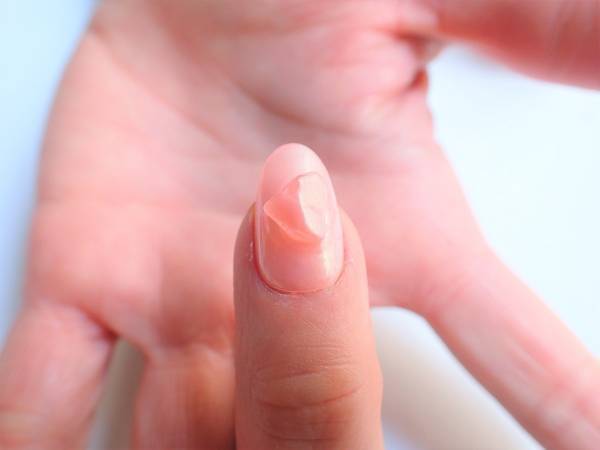 2018年トレンドカラー「ピンク」で作るハンサムネイル【マニキュアでセルフネイル】