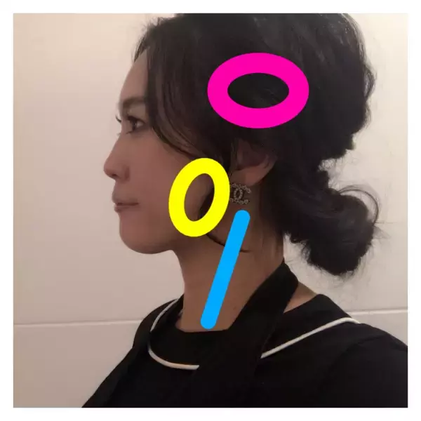 エラ張り・大顔の悩みには「咬筋ほぐし」でアプローチ