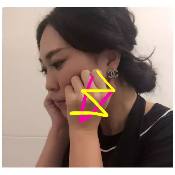 エラ張り・大顔の悩みには「咬筋ほぐし」でアプローチ