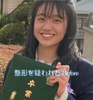 高校卒業時から華麗なビフォーアフターを披露した、あんなさん