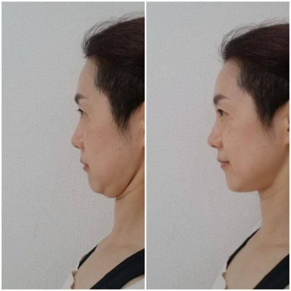 1か月半で見違える！「フェイスラインすっきり法」