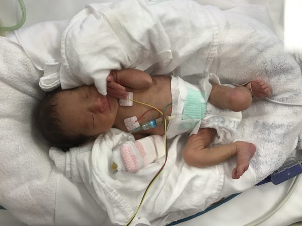 低出生体重児だった娘を育てて感じること、私を支えてくれた言葉