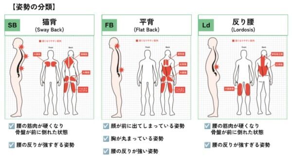 会社員には“猫背”が多い⁉　理学療法士による「姿勢チェック」結果を発表