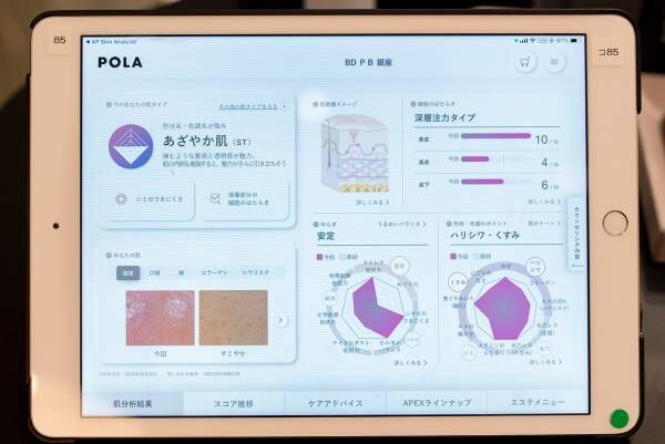 私は「あざやか肌」！　9タイプから診断される新・ポーラの肌分析が面白い