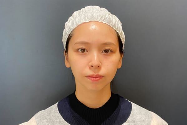 美容医療が人気の今、あえて選びたい資生堂の美顔器「EFFECTIM（エフェクティム）」。オリジナル3D肌解析機を体験！