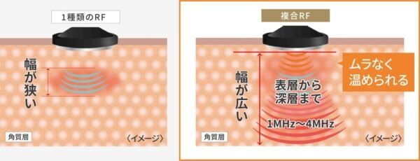 エイジングケアに効果大⁉　ヤーマン美顔器「フォトプラス ディープリフト」発売