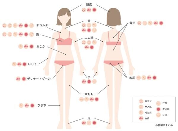 肌の露出が増える夏！　からだのブツブツケアができている人はわずか2割に