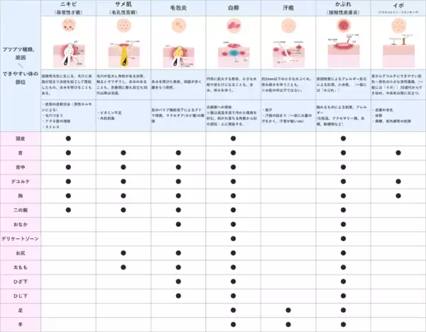 肌の露出が増える夏！　からだのブツブツケアができている人はわずか2割に