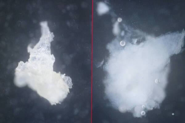 角栓だけではなく“謎のぷつぷつ＝毛山”までケアできる!?　エストのジェル洗顔がパワーアップ