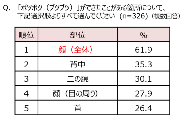お肌のポツポツ、実は“いぼ”かも!?　20〜40代女性の約2人に1人が悩む肌トラブル、薄着の季節になる前に改善するには？