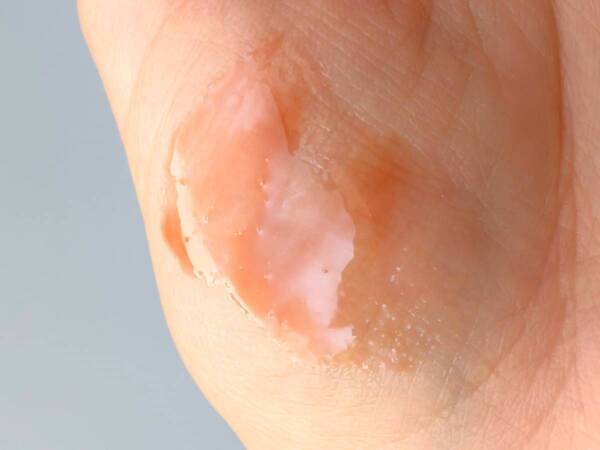 午後のレスキューコスメにおすすめ！　セルヴォーク「モイステン リップドロップ」が日中の砂漠唇に「うるおい・温もり・ツヤ」をON