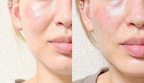 1週間続けたらどう変わる？　2つの球体で表情筋をダイレクトに刺激するBIOAESTECHの美顔器をレビュー