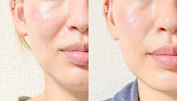 1週間続けたらどう変わる？　2つの球体で表情筋をダイレクトに刺激するBIOAESTECHの美顔器をレビュー