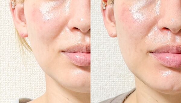 1週間続けたらどう変わる？　2つの球体で表情筋をダイレクトに刺激するBIOAESTECHの美顔器をレビュー