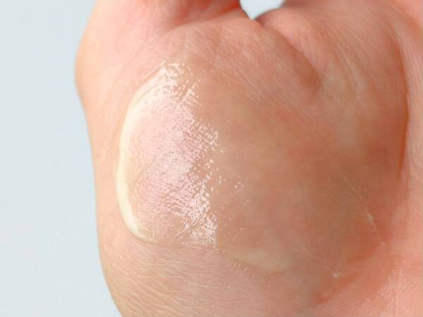 敏感・乾燥肌の私が続けられた！　“レチノール貯金”におすすめしたいトゥヴェール「レチノショット0.1」