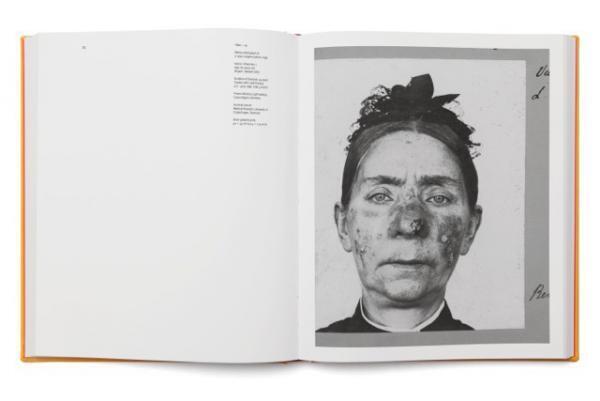 ノーベル賞科学者が考案した光線療法による“見えない光”を写真で視覚化【ShelfオススメBOOK】