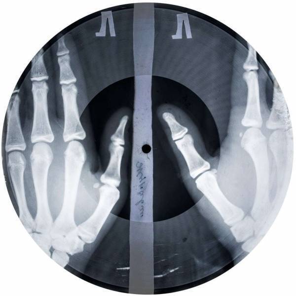展覧会「BONE MUSIC展」が原宿で、冷戦下ソビエトが生んだ“レントゲン写真”製レコードの歴史