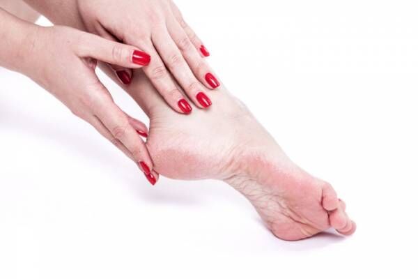 dehydrated skin on the heels of female feet with calluses