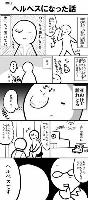 ある朝、目元に『謎の腫れ』が！　皮膚科受診が遅れた結果…？