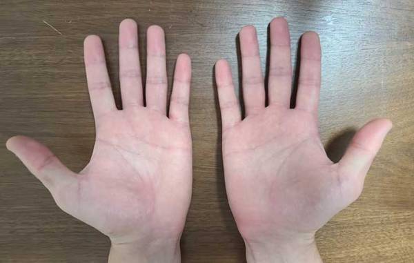 手相の見方が分からない！　基本は右手、左手どっち？　生命線は長さではなく…