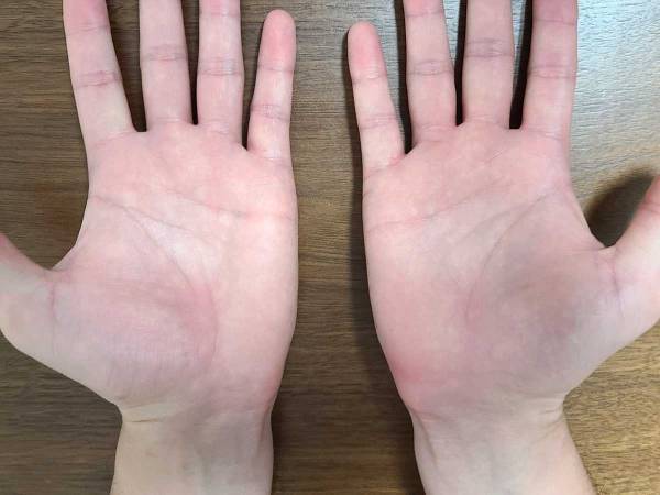 手相の見方が分からない！　基本は右手、左手どっち？　生命線は長さではなく…