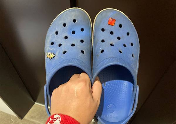 足に謎の斑点ができた男性　判明したまさかの原因とは？　「笑った」「同じ経験ある」