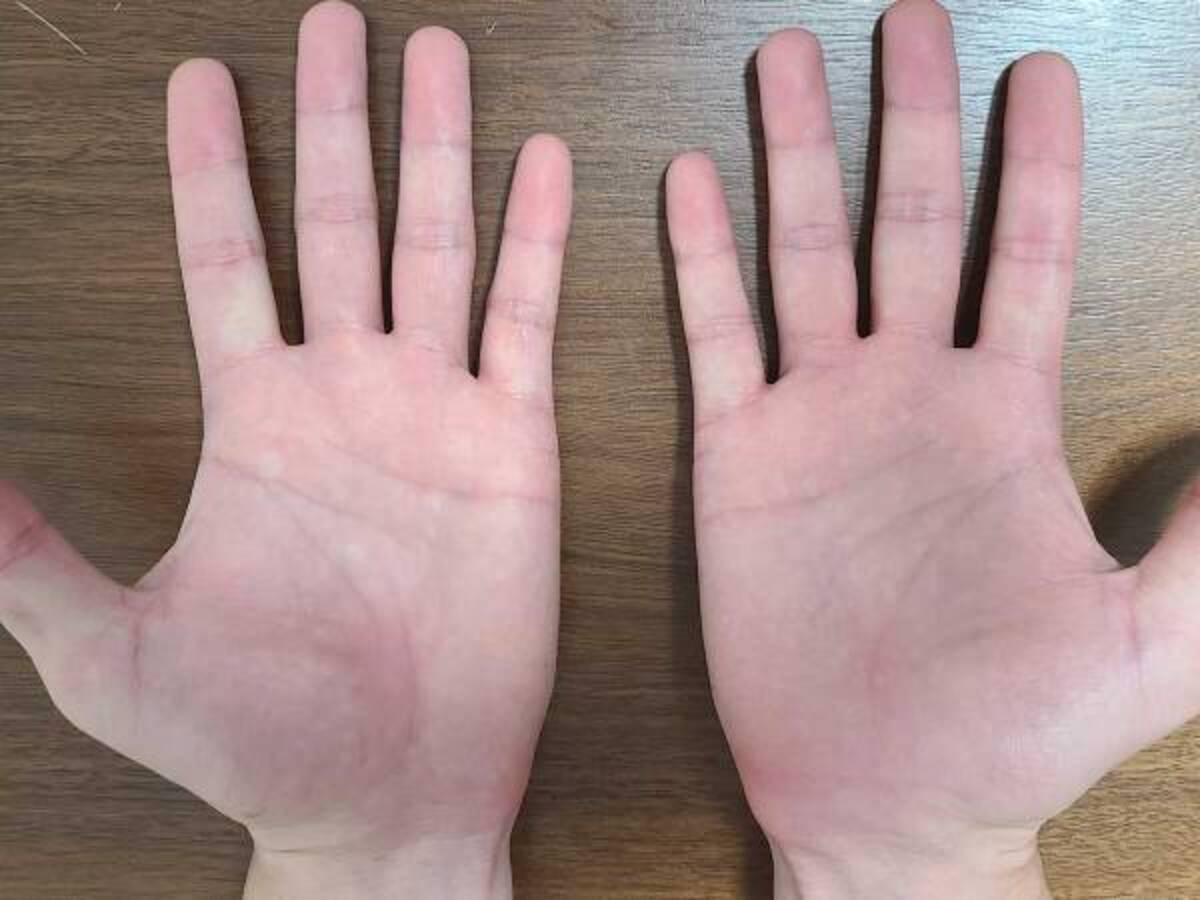 手相は右手と左手どちらを見たらいい 島田秀平は多くの占い師と違って 年9月15日 ウーマンエキサイト 1 4