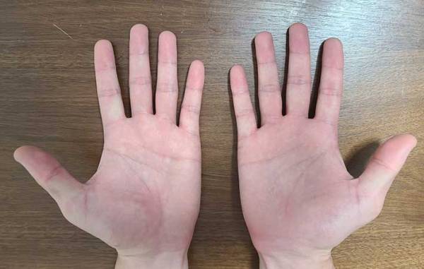 手相は右手と左手どちらを見たらいい？　島田秀平は多くの占い師と違って…