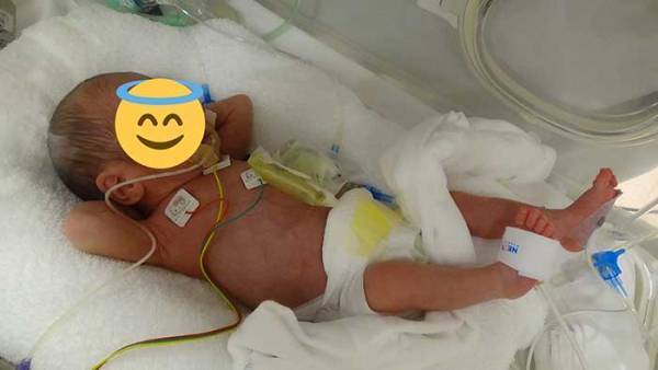 「こんな赤ちゃん、見たことない」　パパが笑った、我が子の姿とは