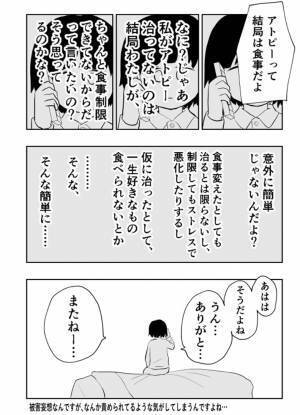 アトピーに悩む女性が傷付いた『助言』に、共感の声　「分かる」「簡単に言わないでほしい」
