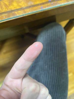 「目がおかしいのかと思った！」　何の変哲もないゴミかと思いきや…